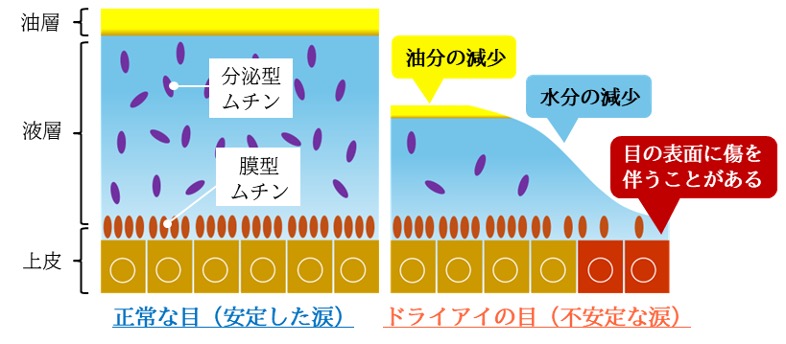 点眼薬治療